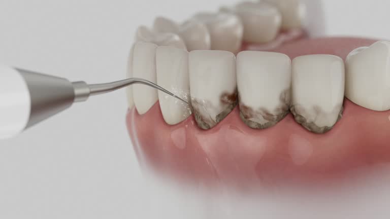 Trusted Teeth Whitening service in Ackerman, MS - Dentist Open Now